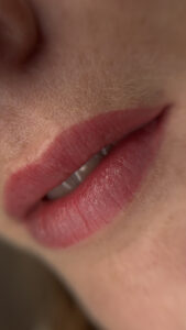 Lippenpigmentierung_1